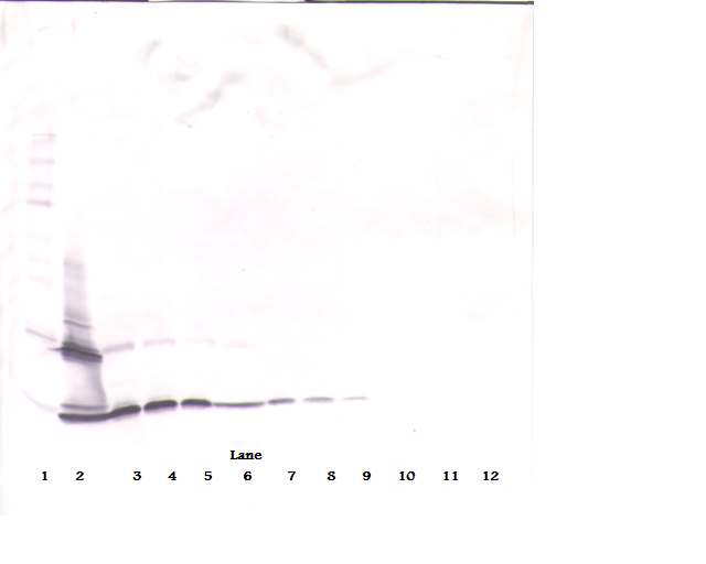 PDGF-BB Antibody