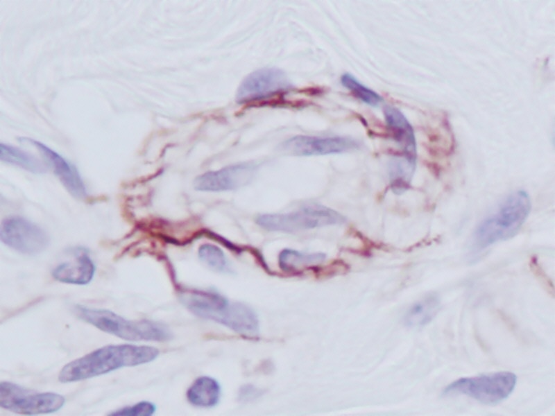 PDGF-BB Antibody