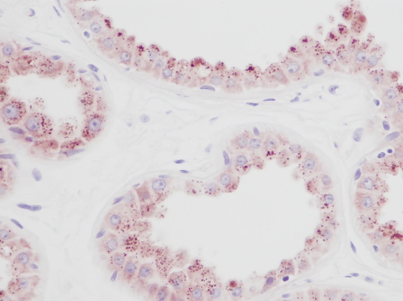 PDGF-BB Antibody