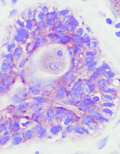 PDGF-AA Antibody