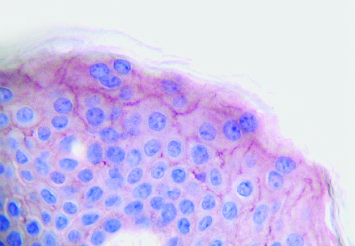PDGF-AA Antibody