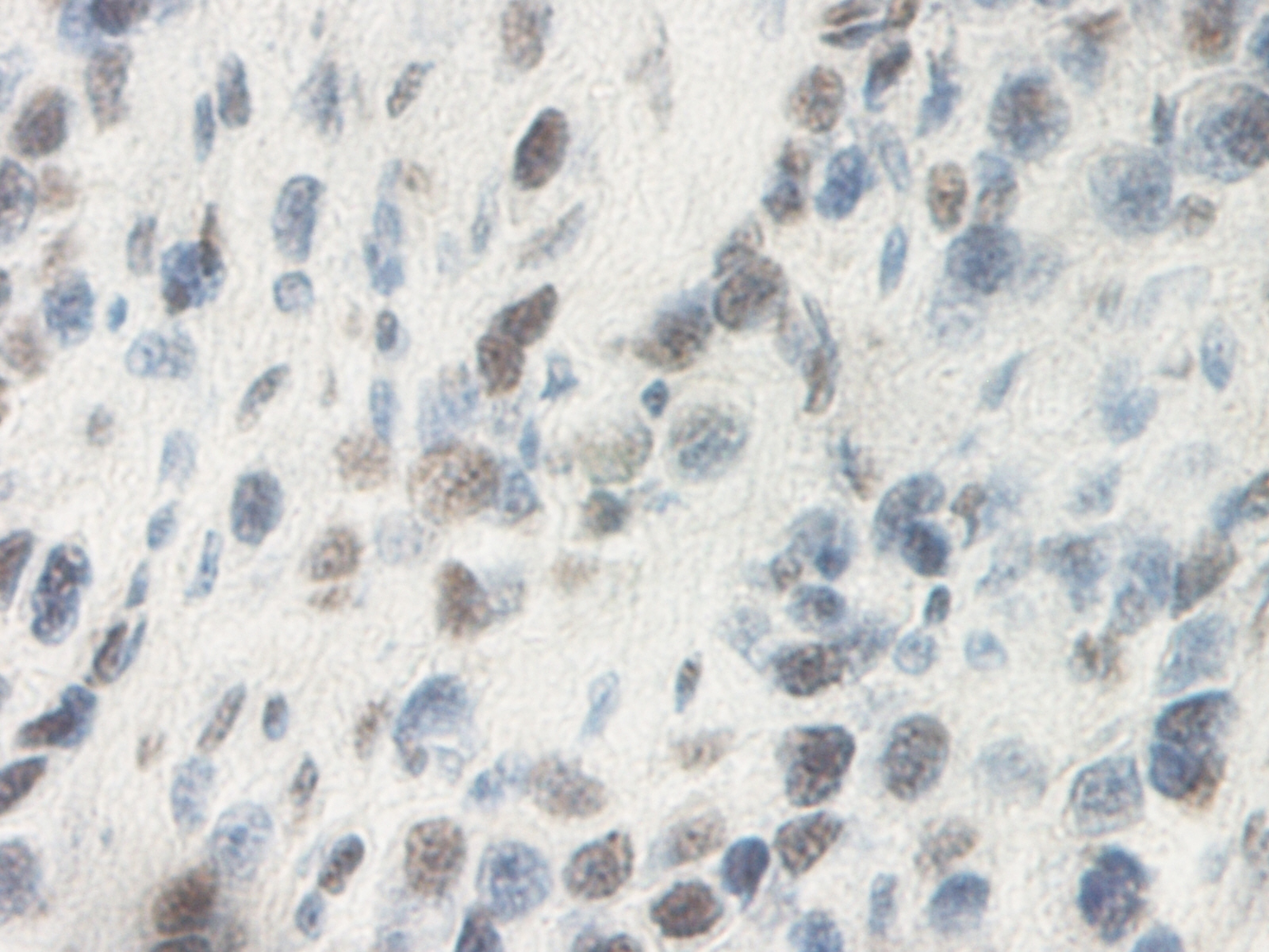 OSM Antibody