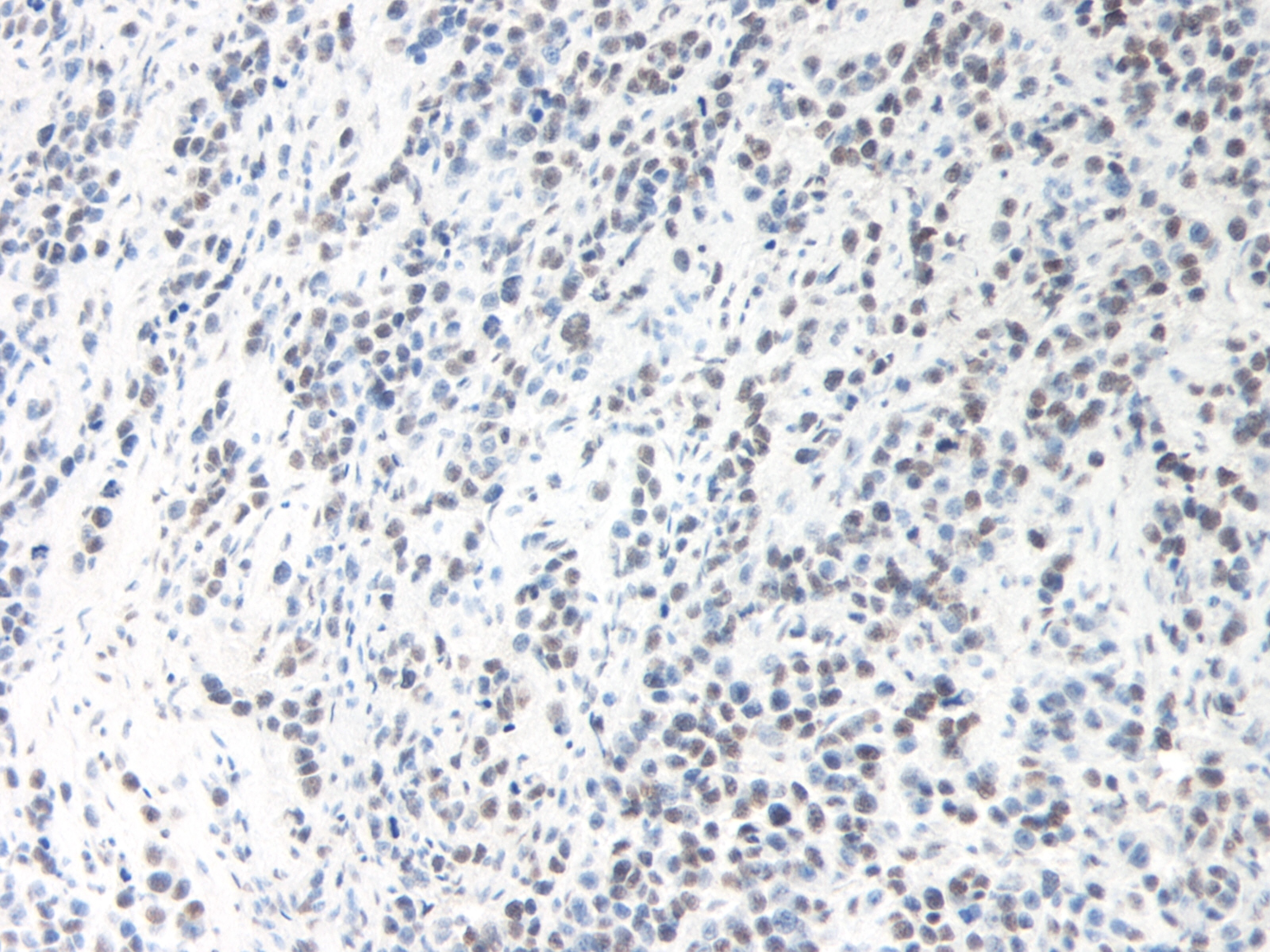 OSM Antibody