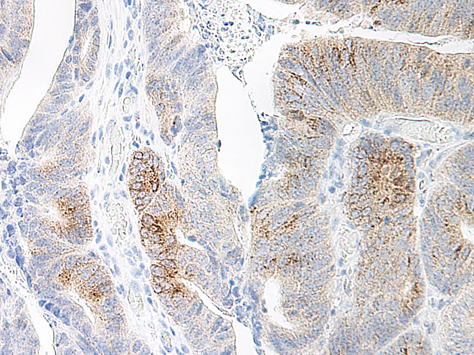 CCL20 Antibody