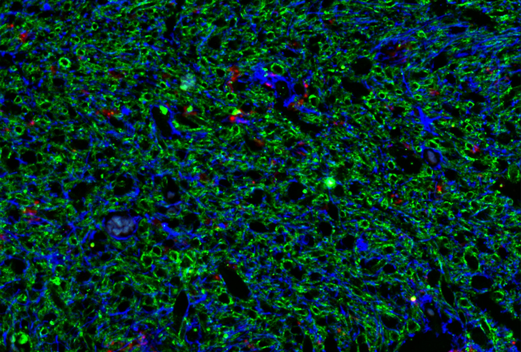 MDK Antibody