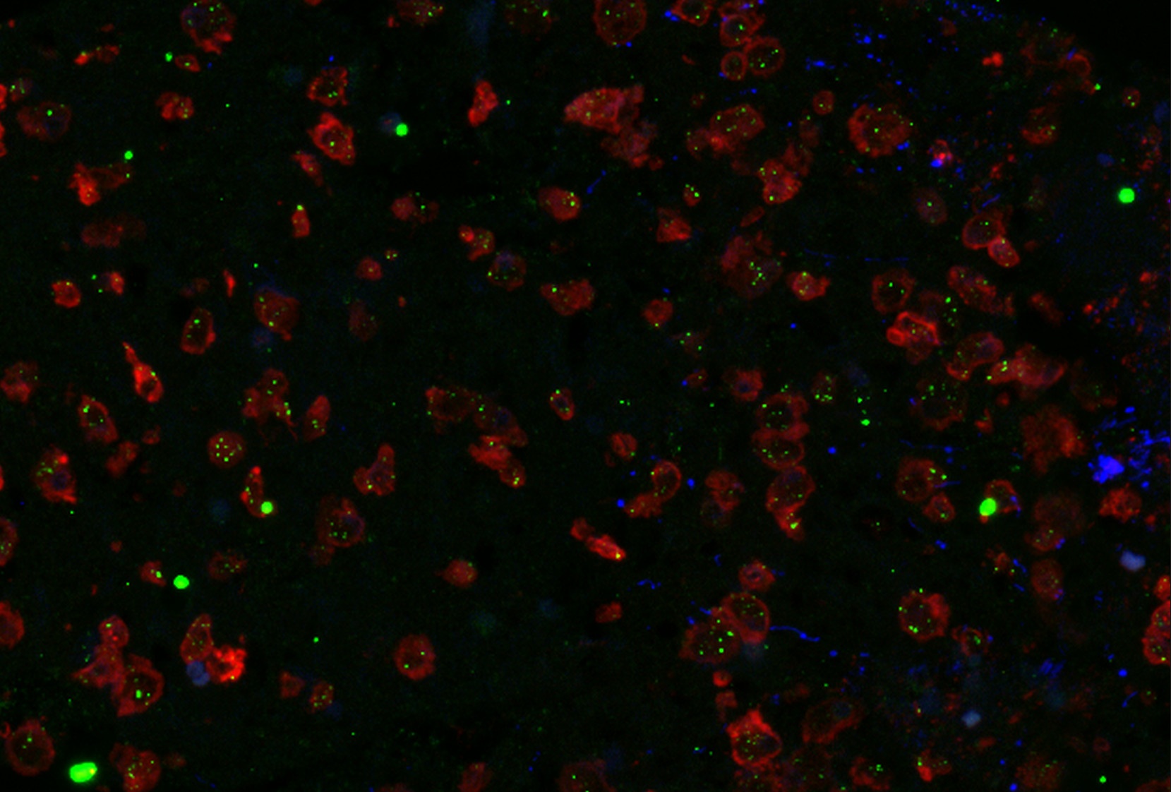 MDK Antibody