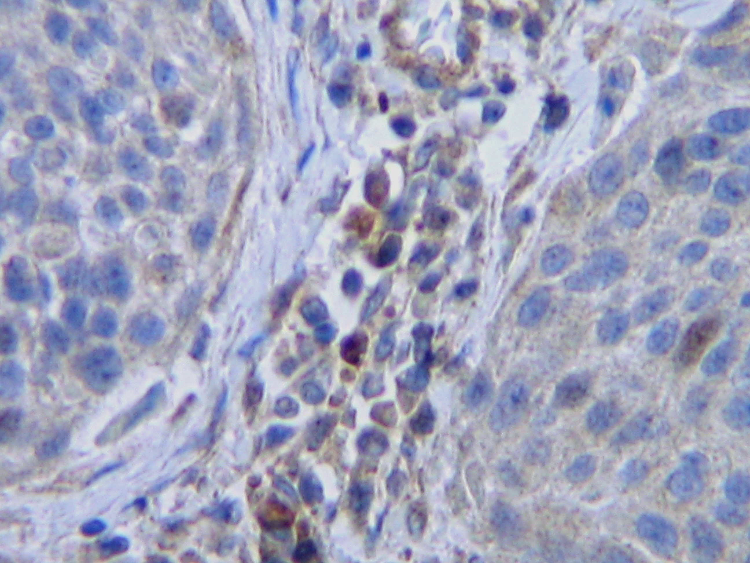 CSF1 Antibody