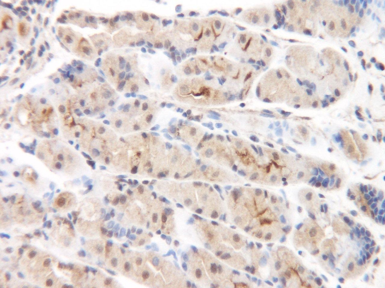 CCL8 Antibody