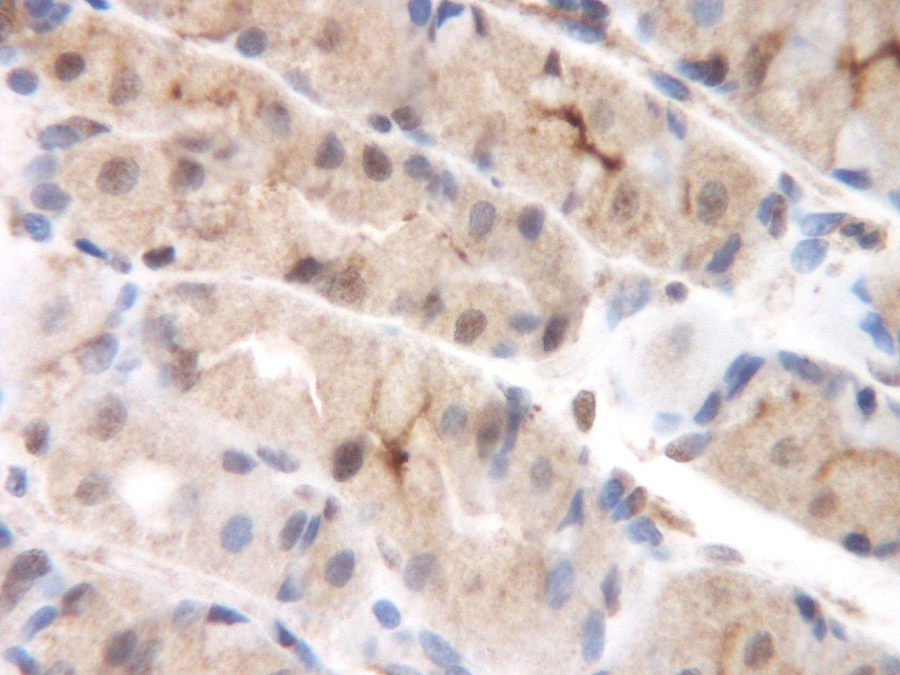 CCL8 Antibody