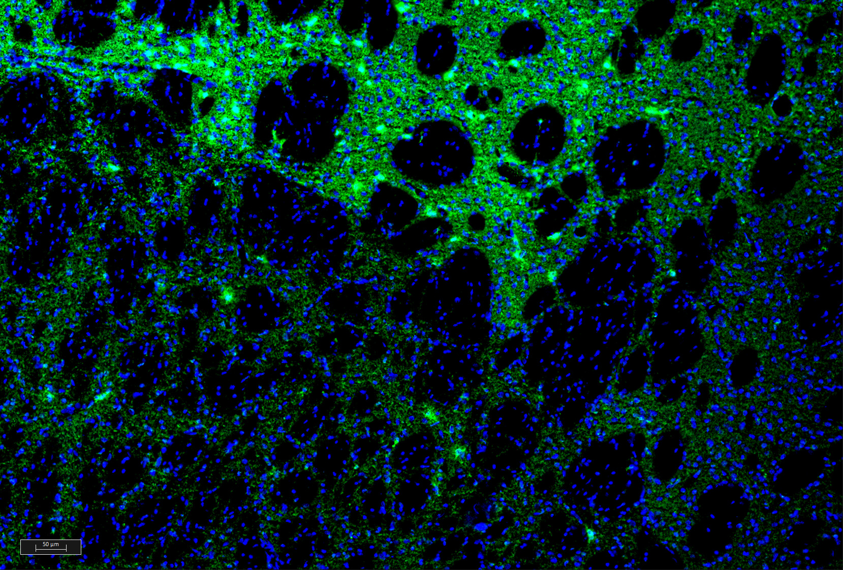 MCP-1/MCAF Antibody