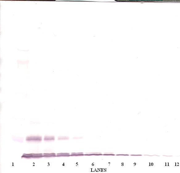 MCP-1/MCAF Antibody