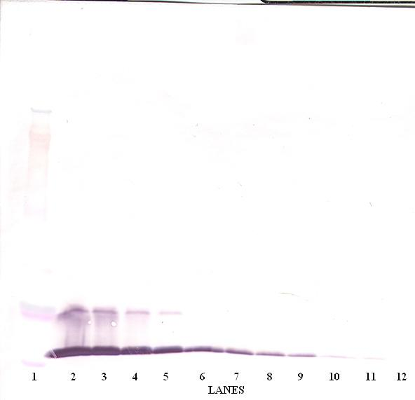 MCP-1/MCAF Antibody