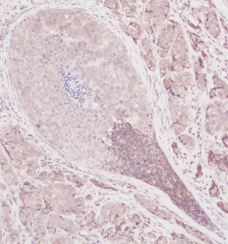 MCP-1/MCAF Antibody