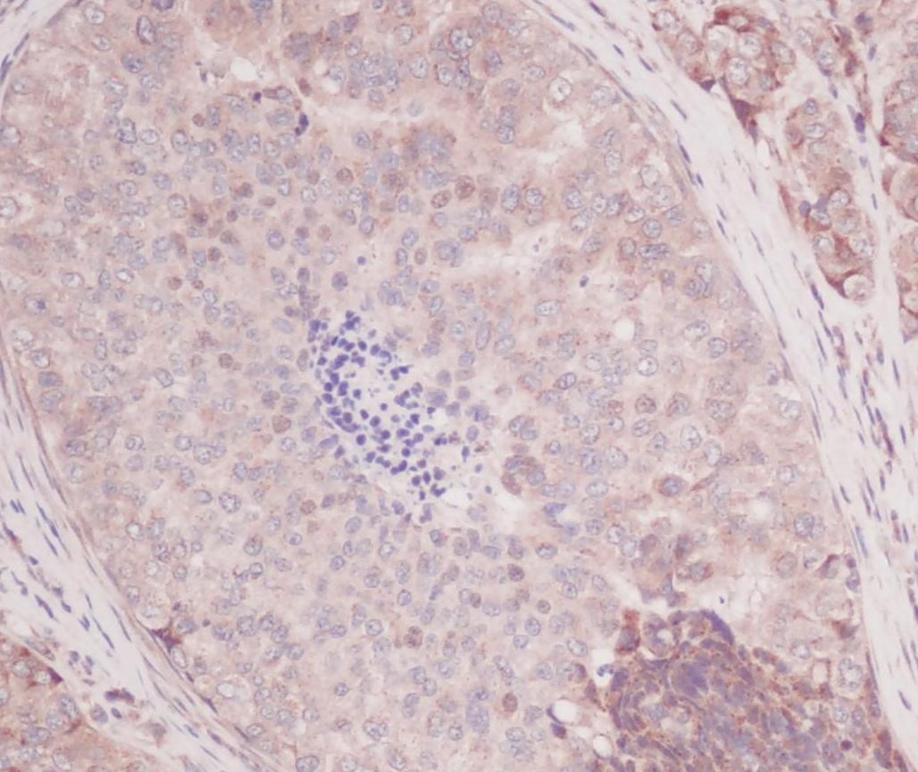 MCP-1/MCAF Antibody