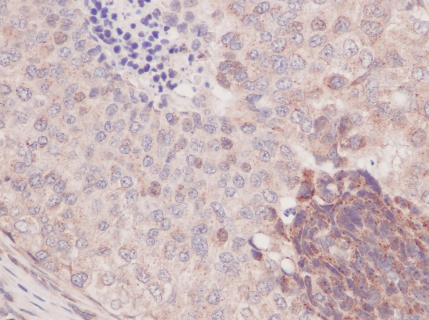 MCP-1/MCAF Antibody