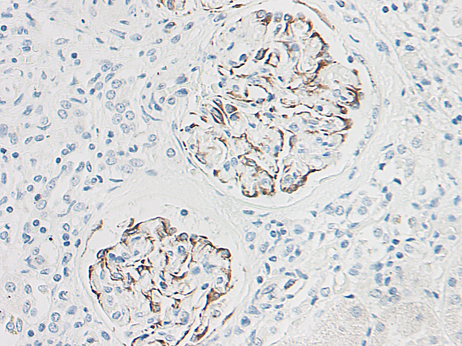 Lymphotactin Antibody