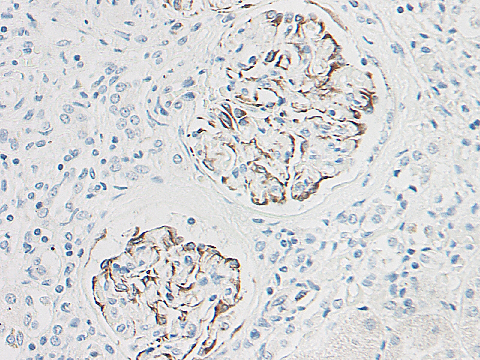 XCL1 Antibody