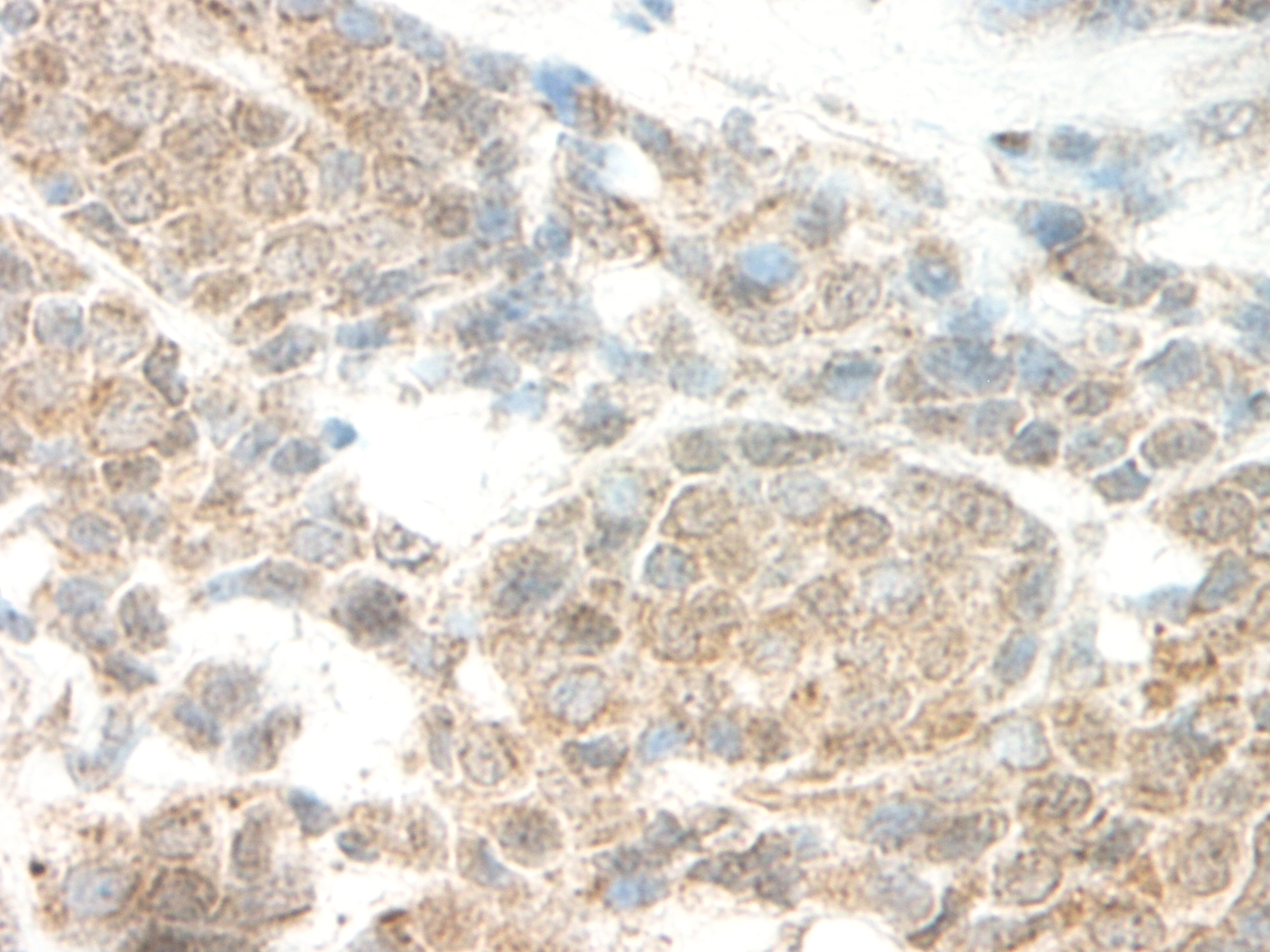 Leptin Antibody