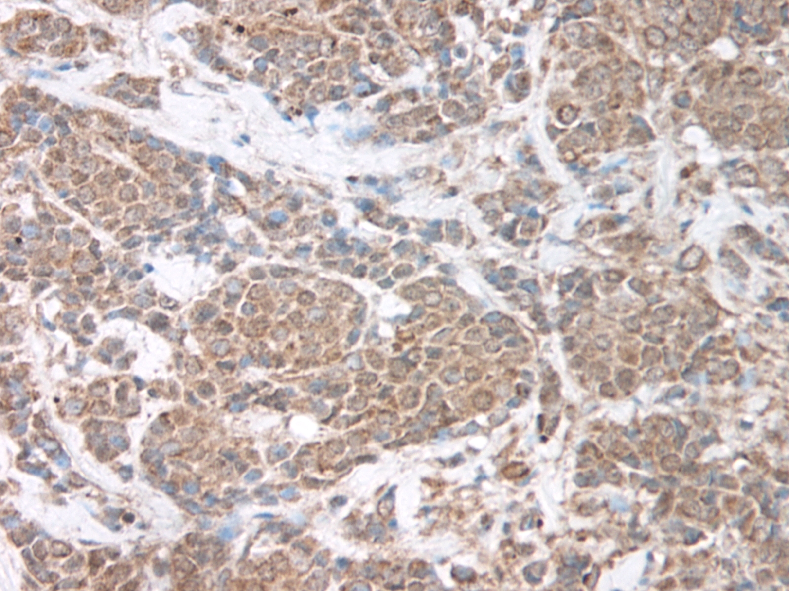 Leptin Antibody