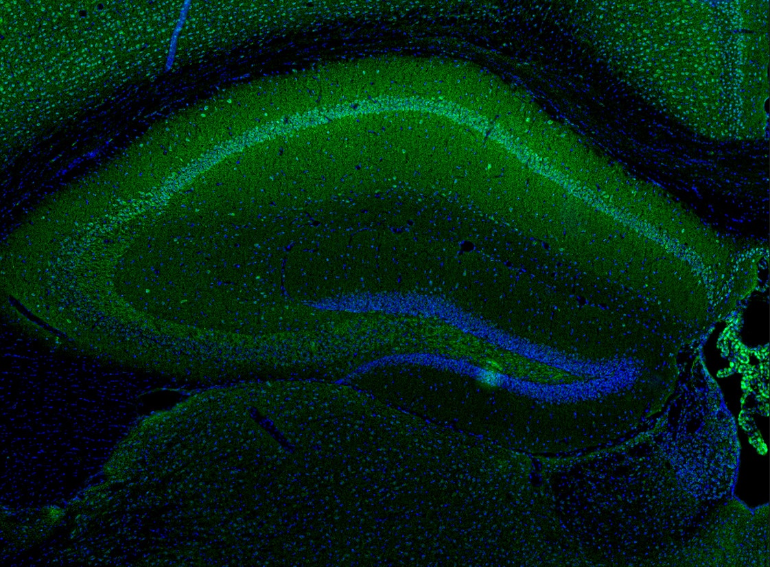 IP-10 Antibody