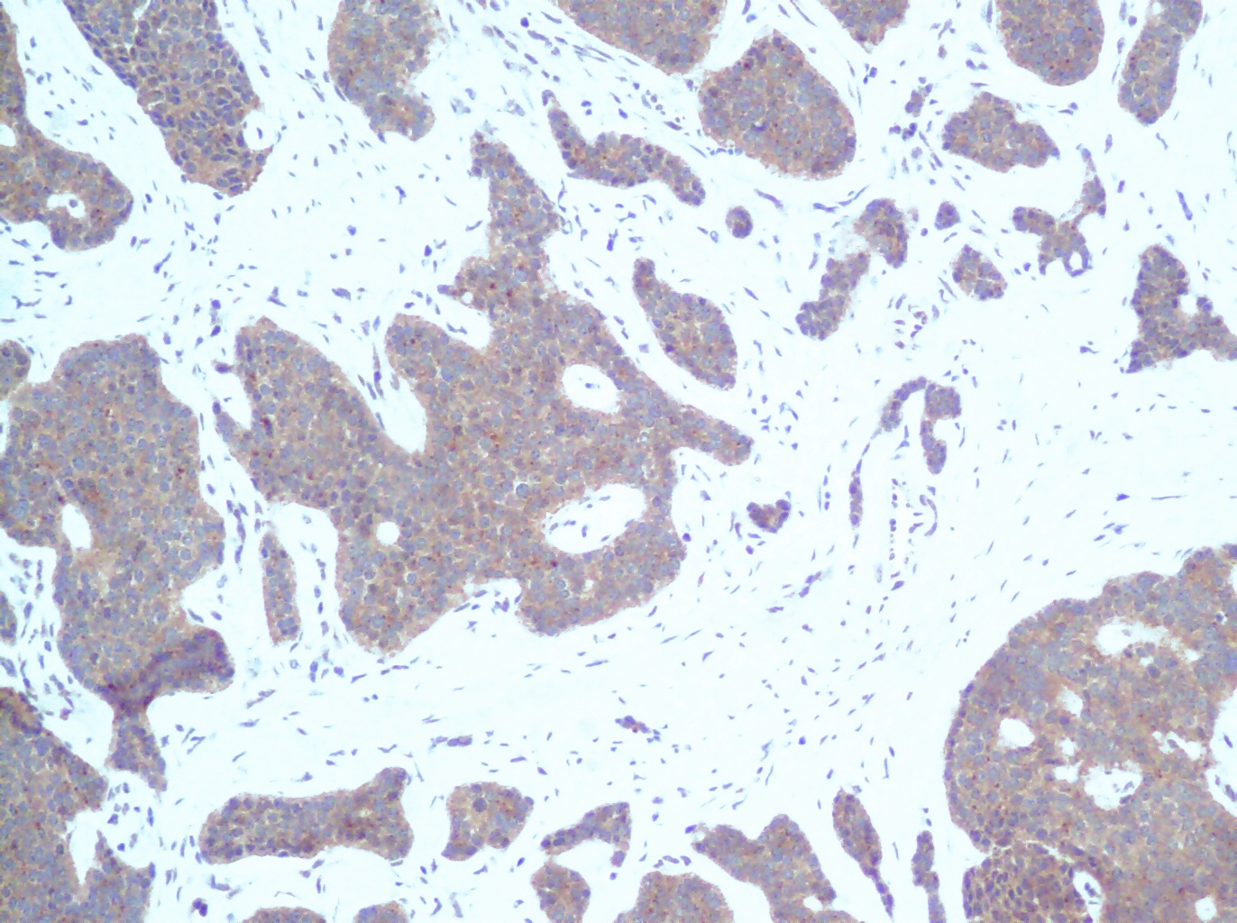 IP-10 Antibody