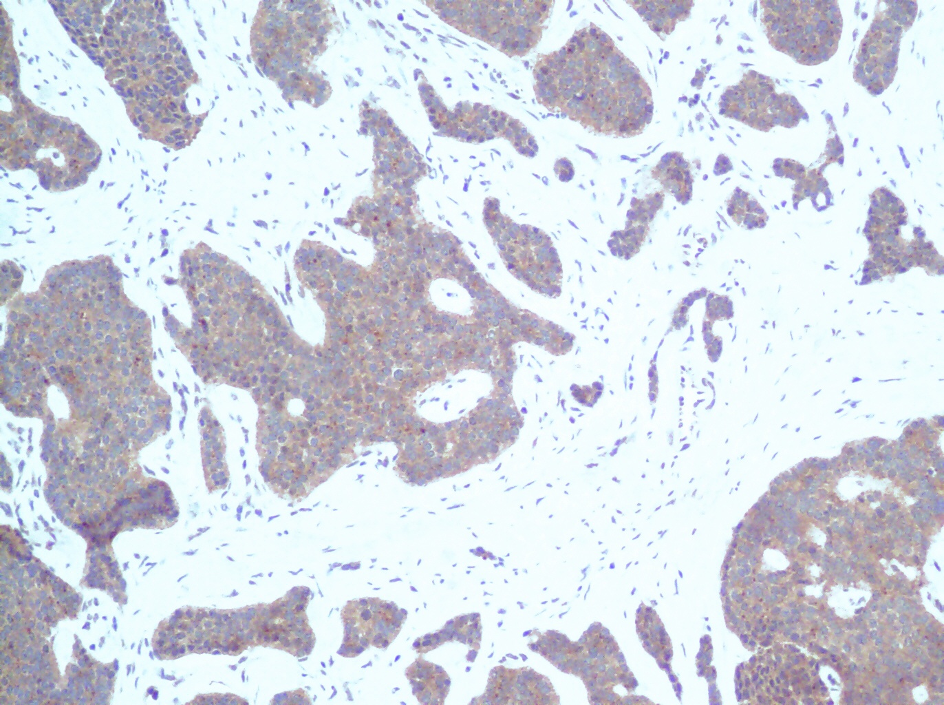 CXCL10 Antibody