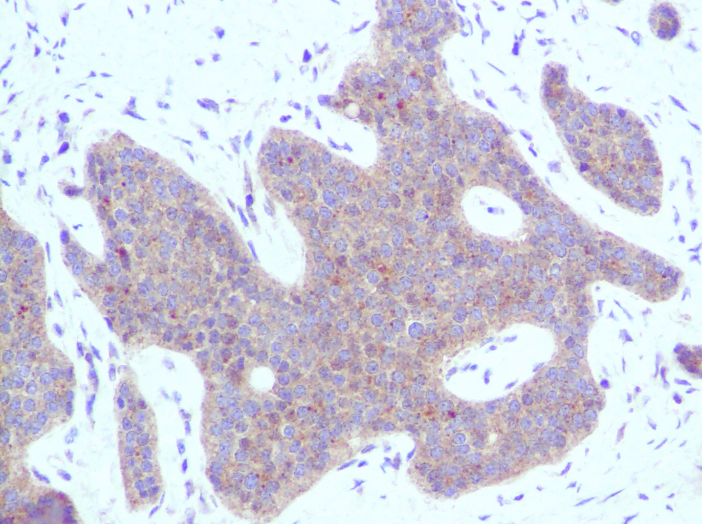 IP-10 Antibody