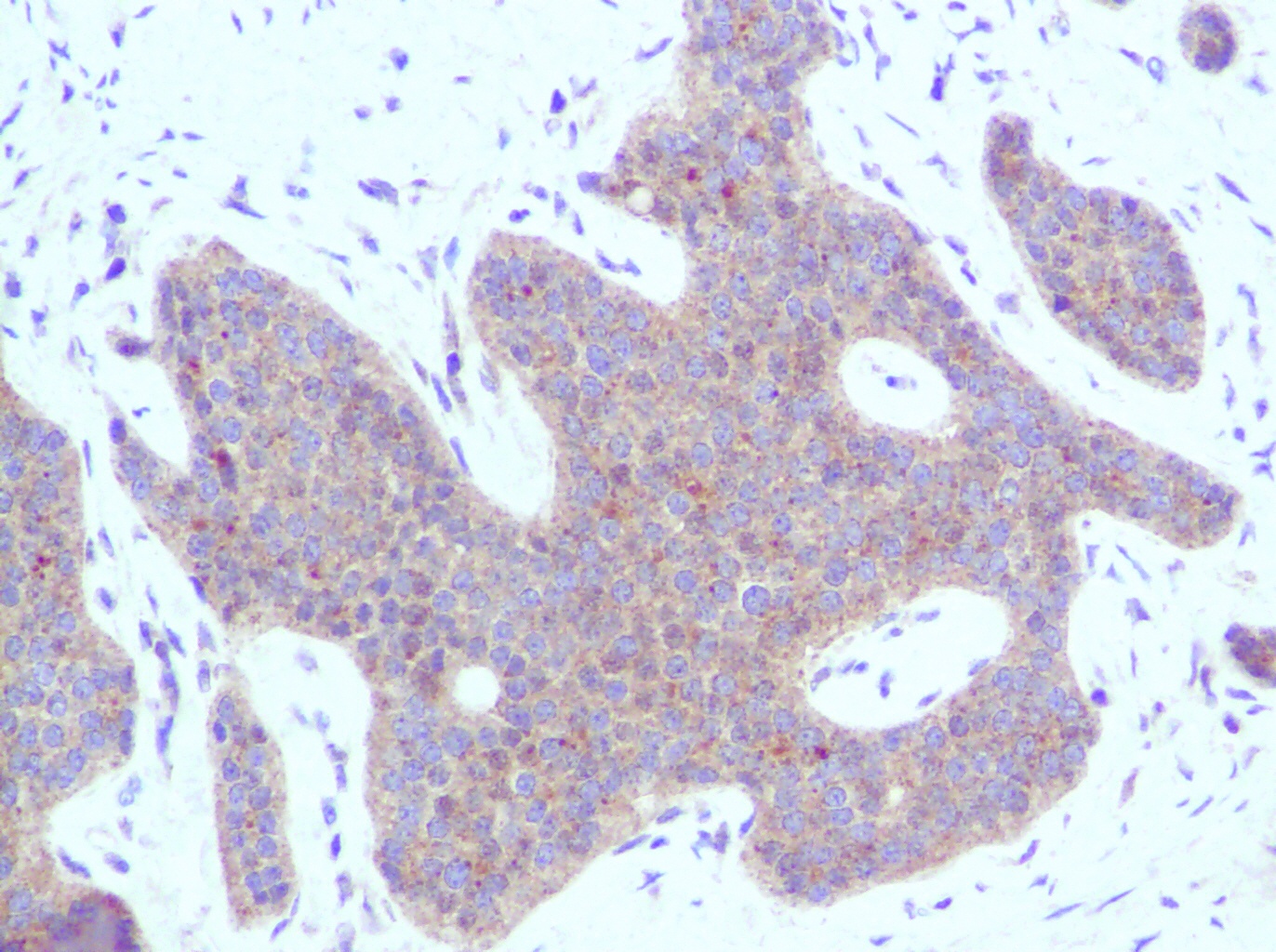 CXCL10 Antibody