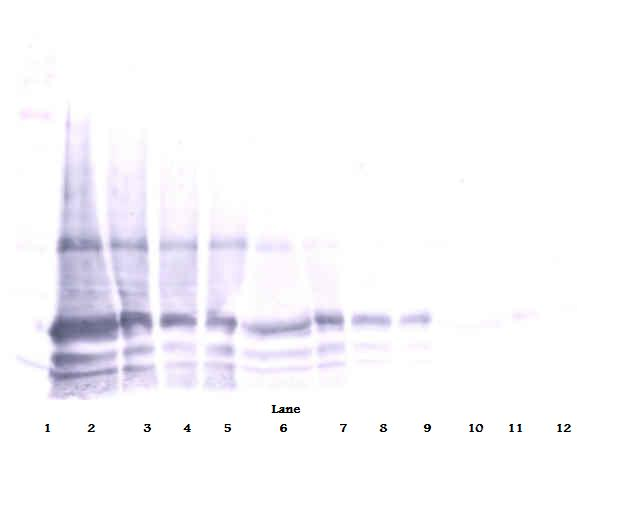 IL-6 Antibody