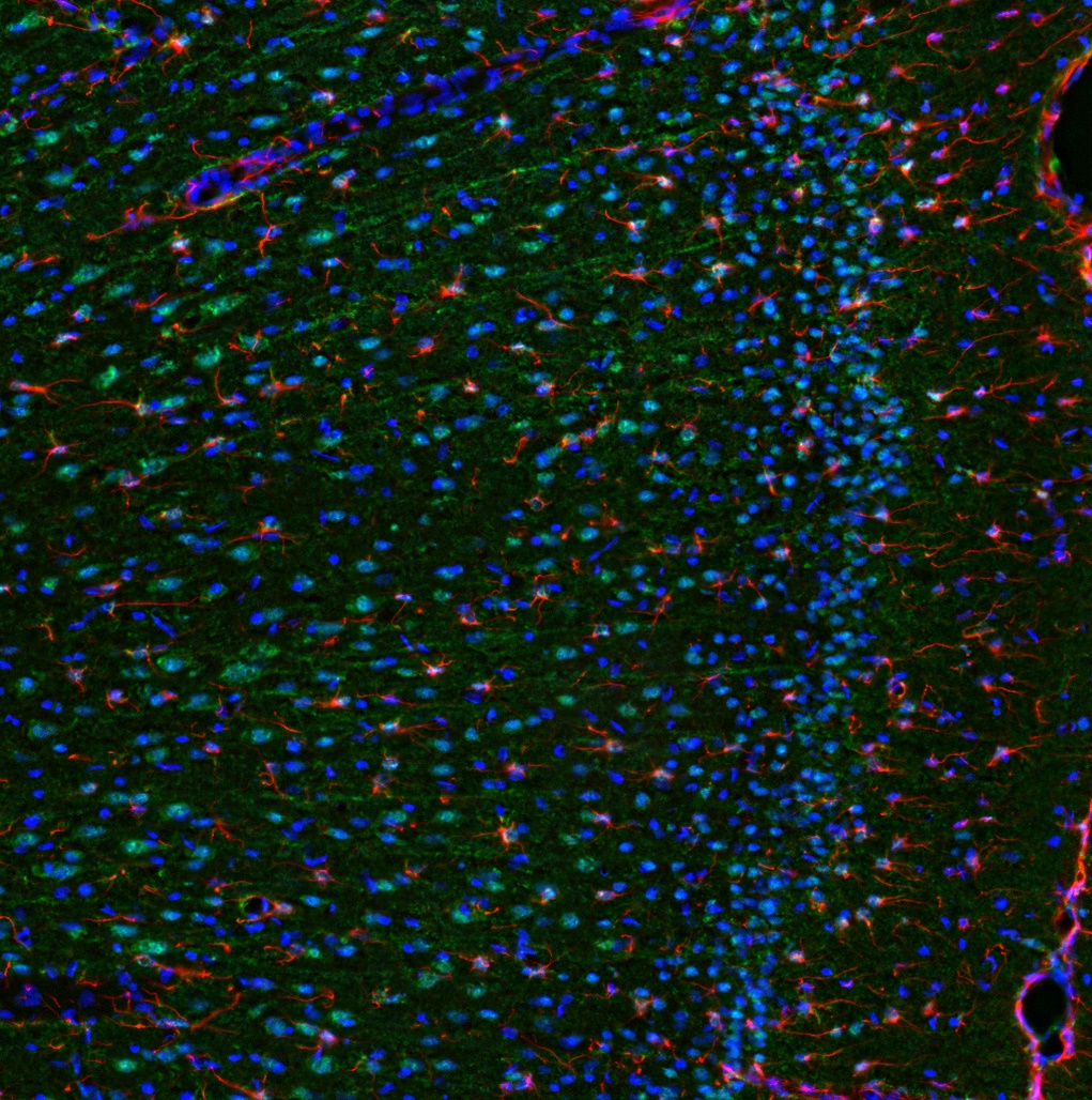 IL-6 Antibody