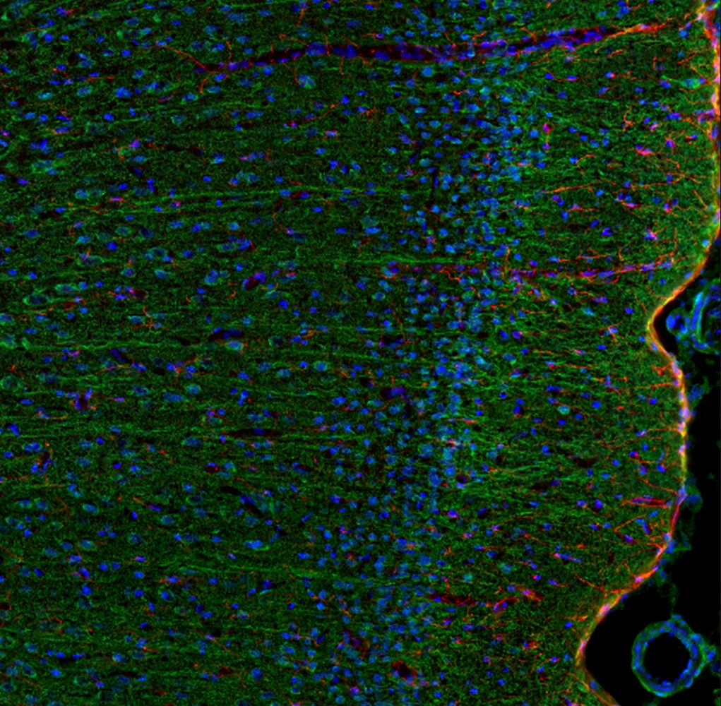 IL-6 Antibody
