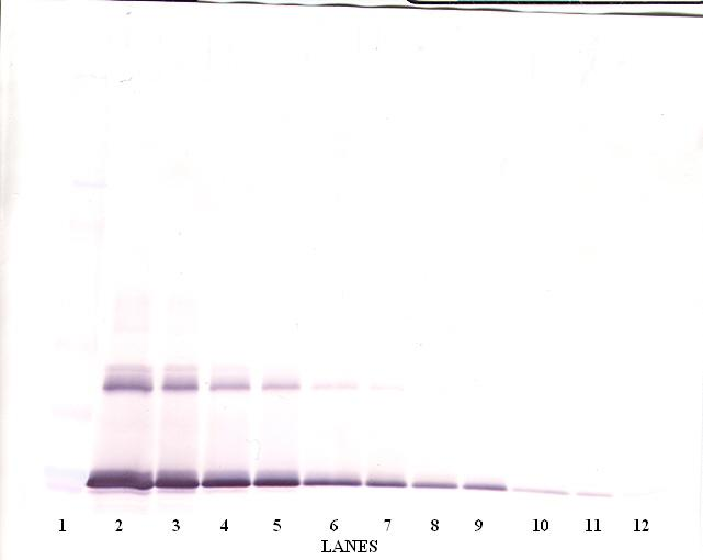 IL-6 Antibody