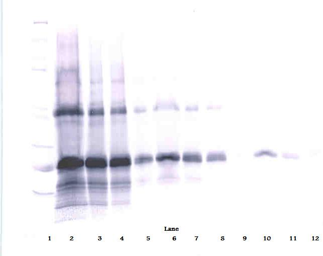 IL-6 Antibody