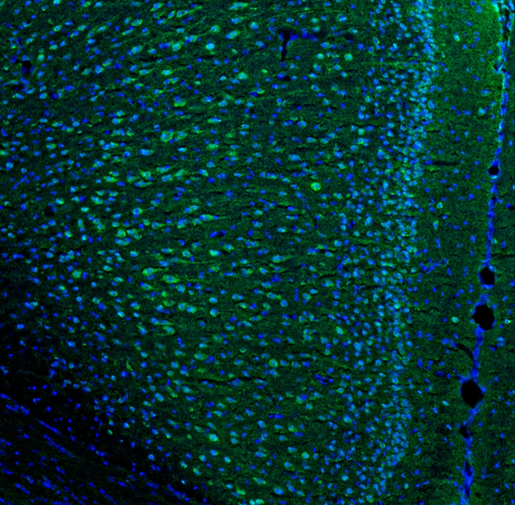 IL-6 Antibody
