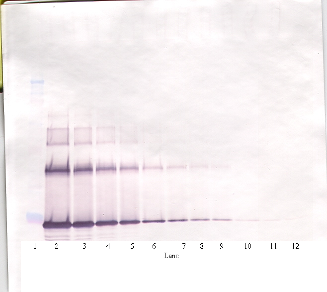 IL6 Antibody