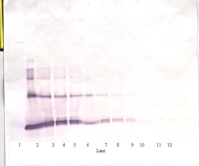 IL6 Antibody