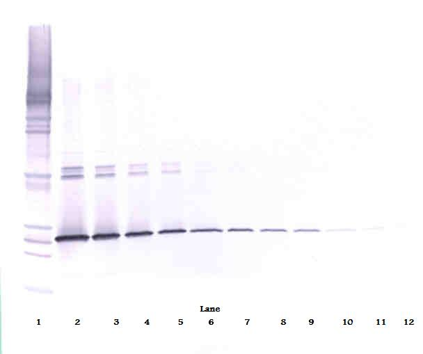 IL-5 Antibody