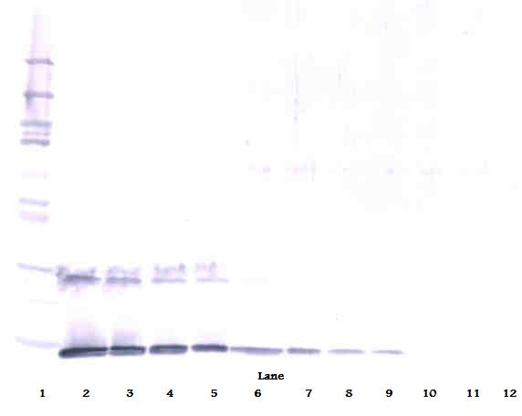 IL-5 Antibody