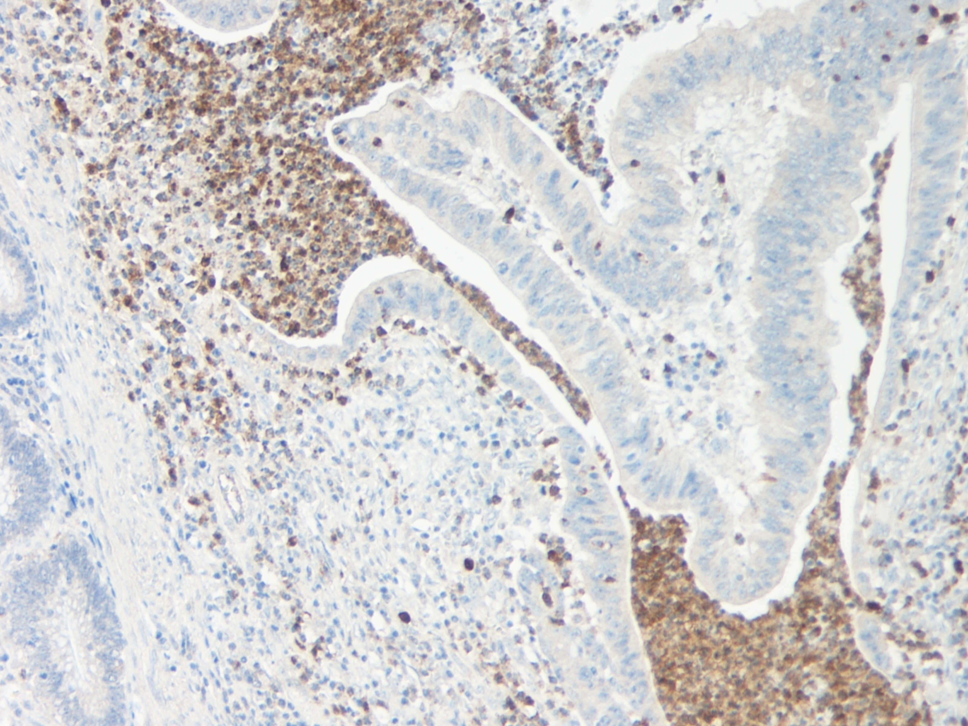 IL-5 Antibody