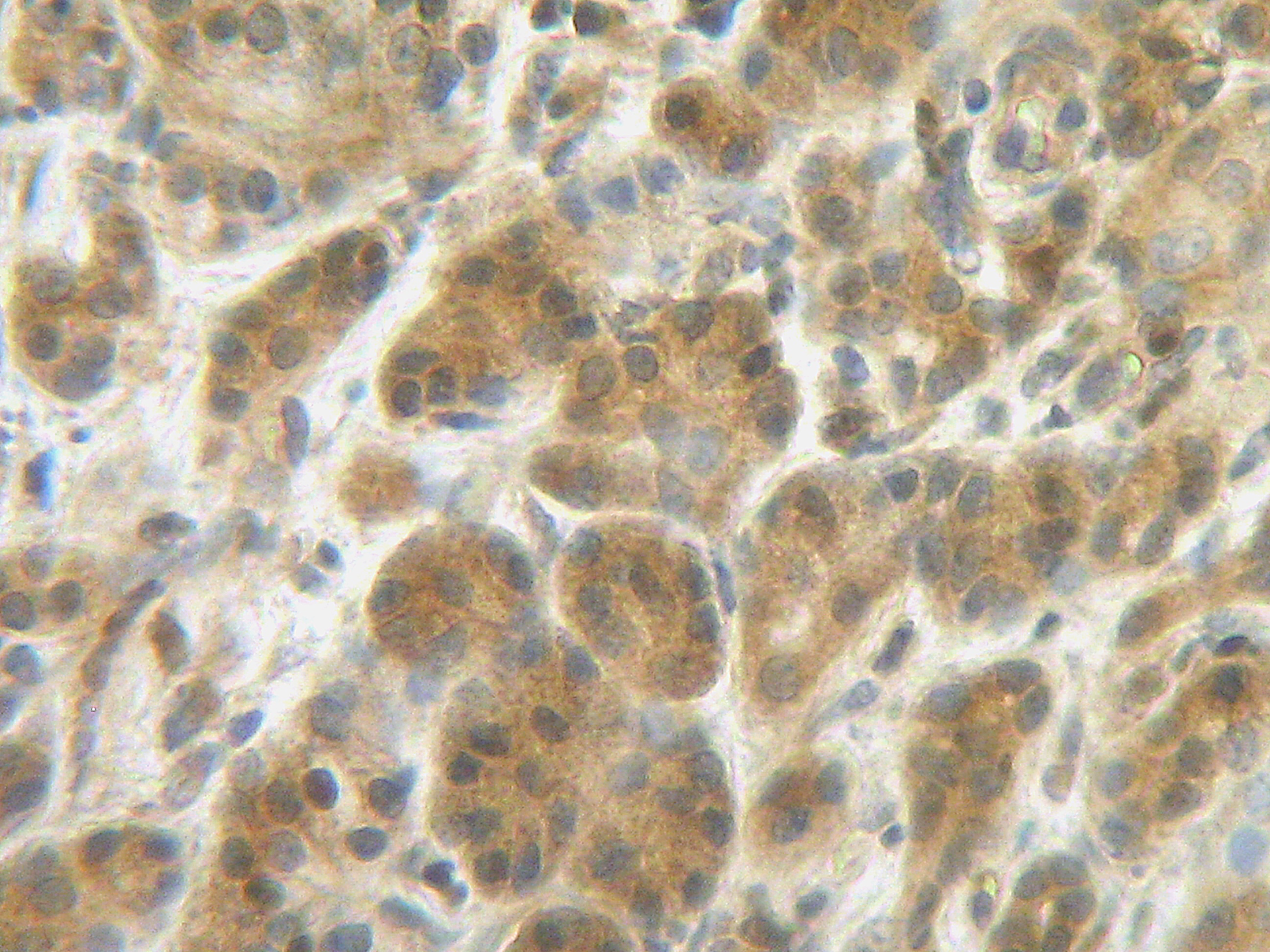 IL-4 Antibody