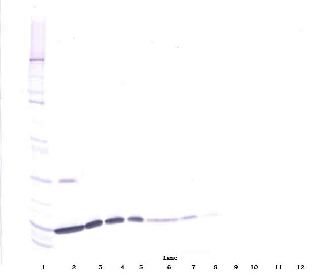 IL-2 Antibody