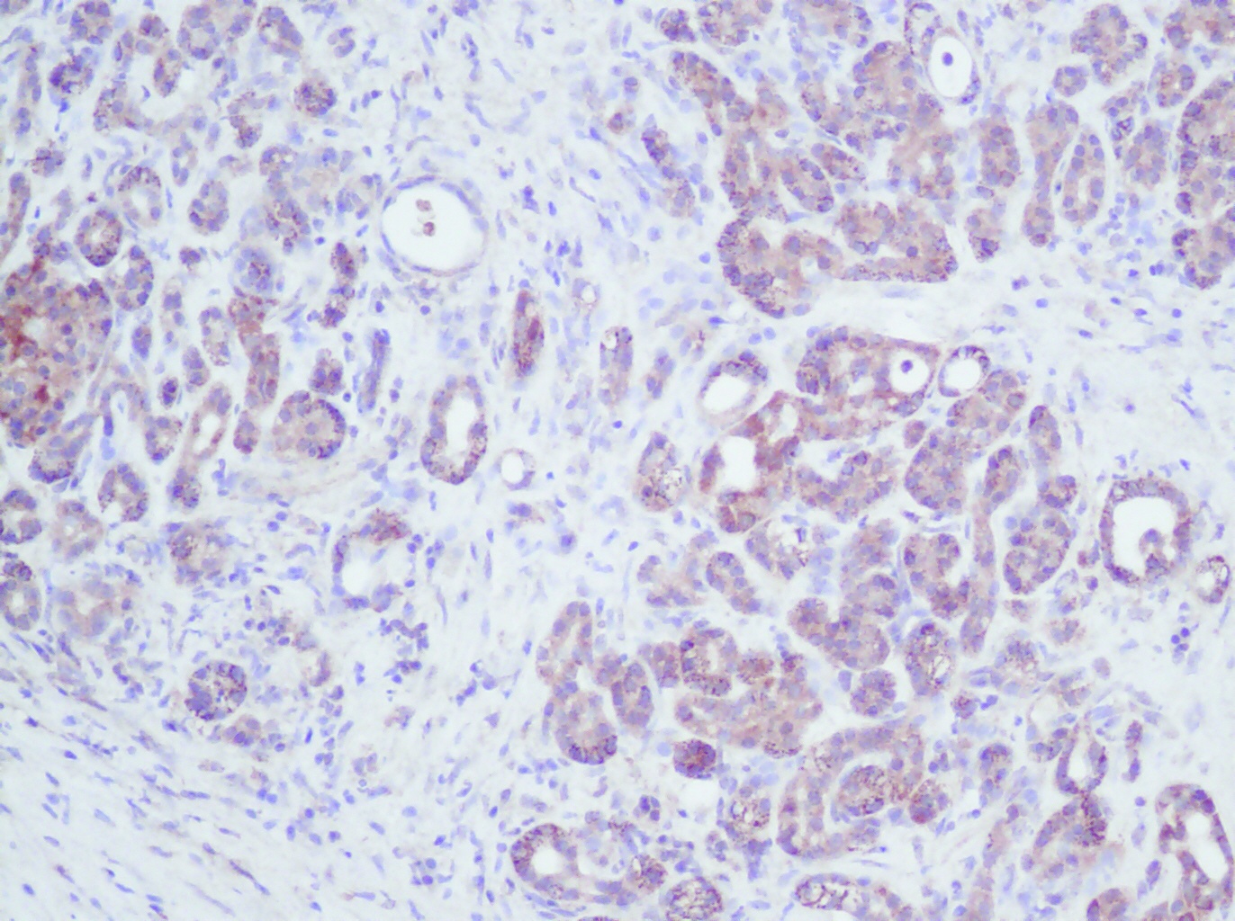 IL-2 Antibody