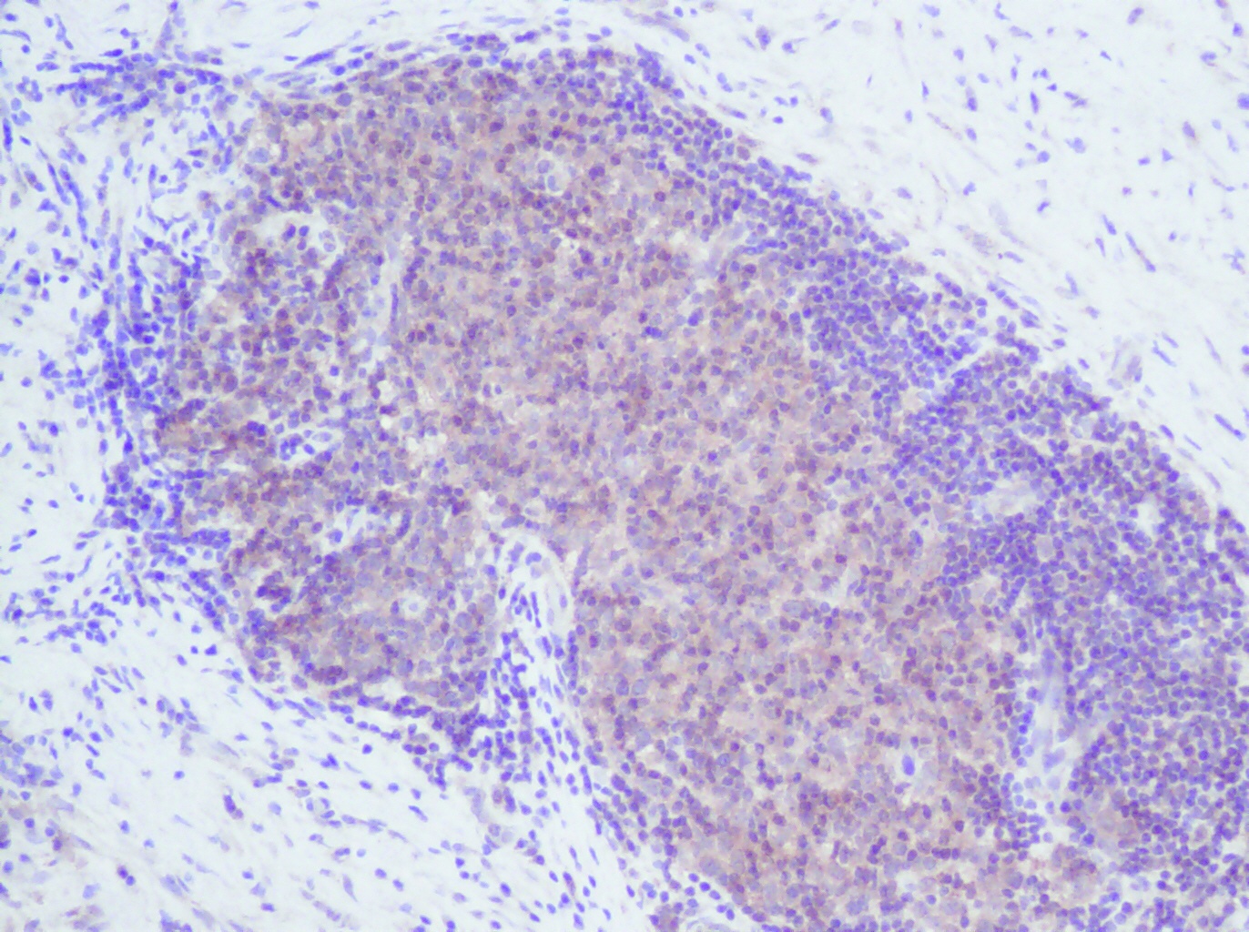 IL-2 Antibody