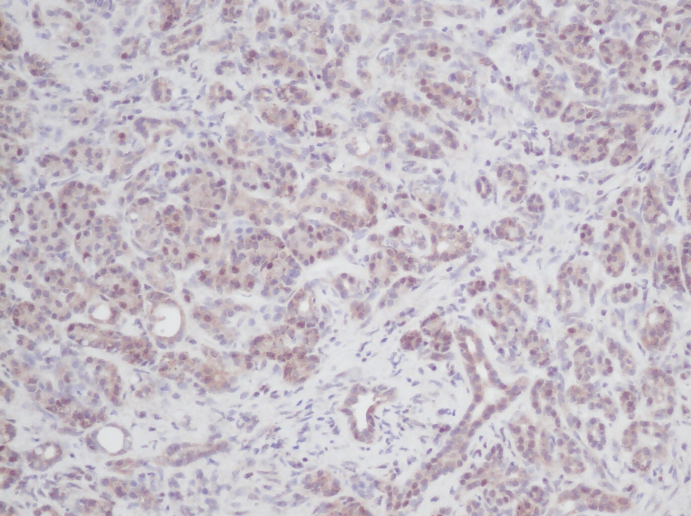 IL-2 Antibody