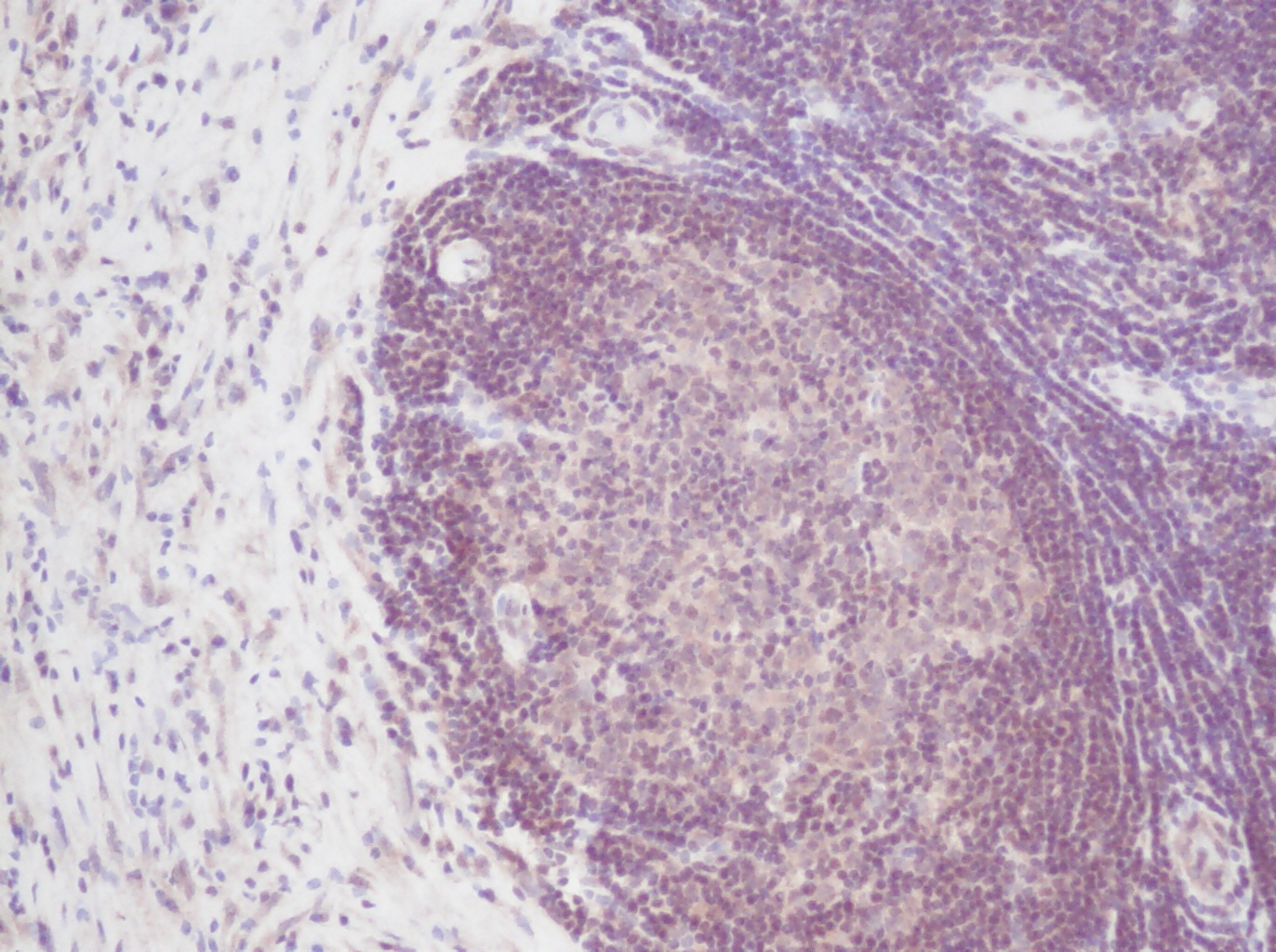IL-2 Antibody