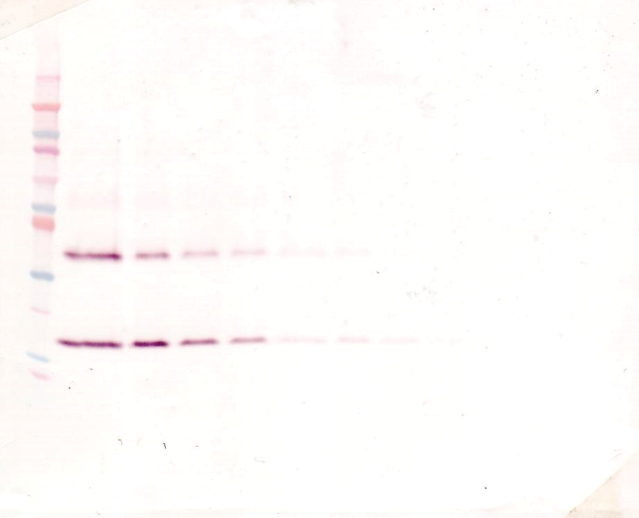 Il1b Antibody