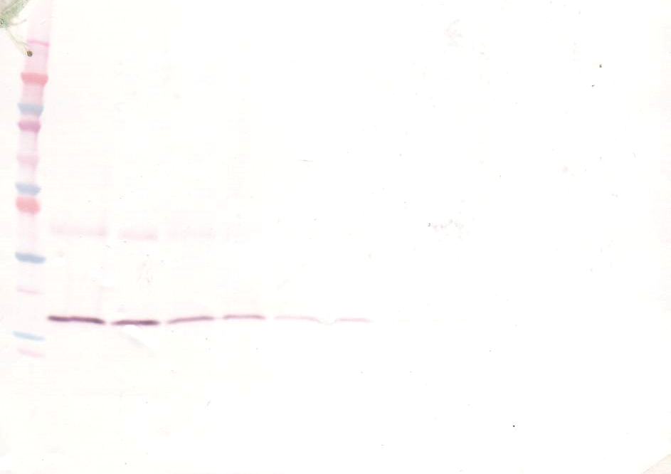 Il1b Antibody