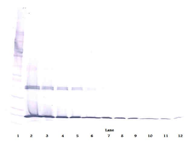 Il1b Antibody