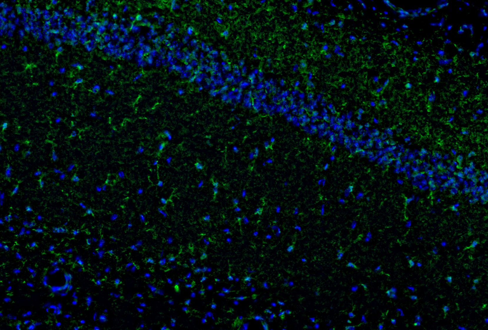 Il1b Antibody