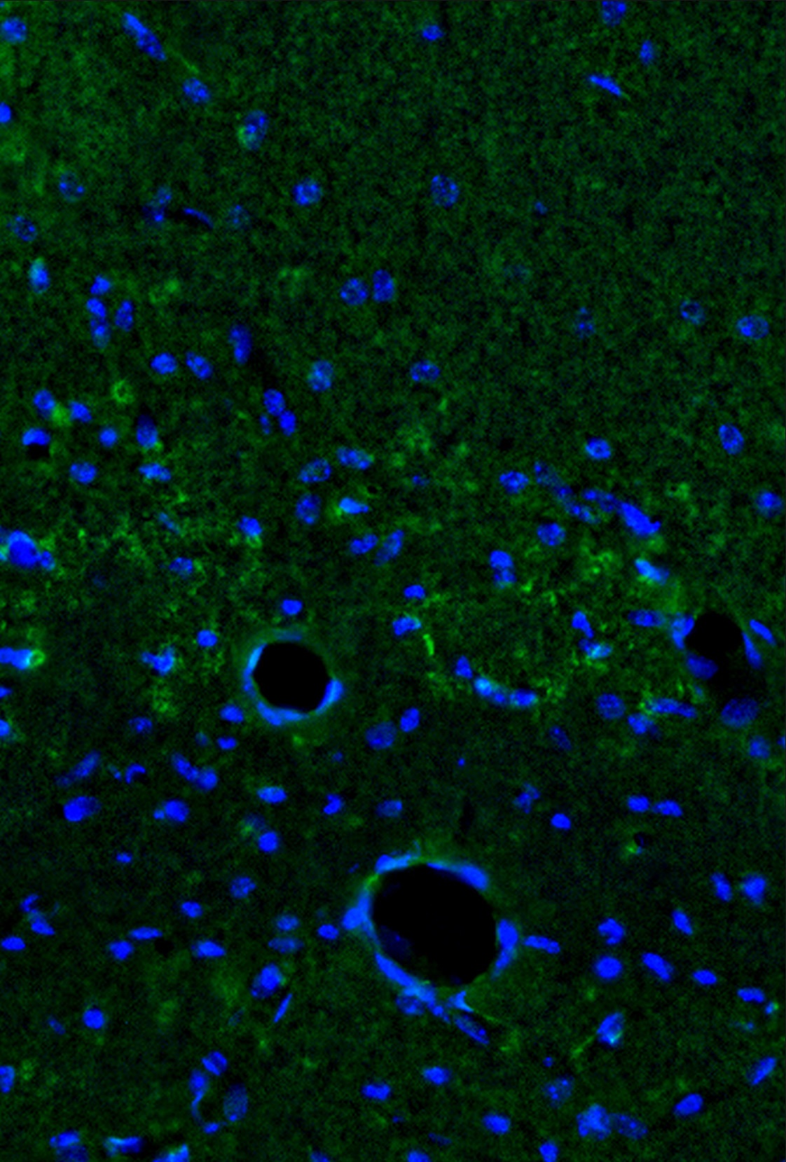 IL-1a Antibody